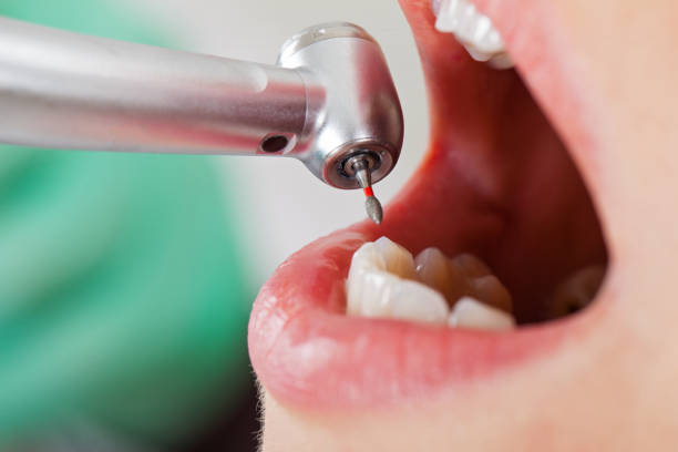 Best Emergency Treatment for Dental Infections or Abscesses in Eureka Springs, AR